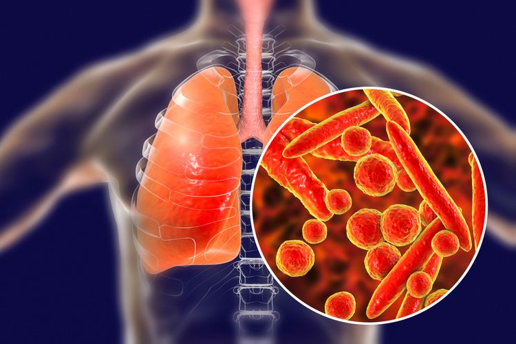 Kenali Penyakit Mycoplasma Pneumoniae Di Tiongkok