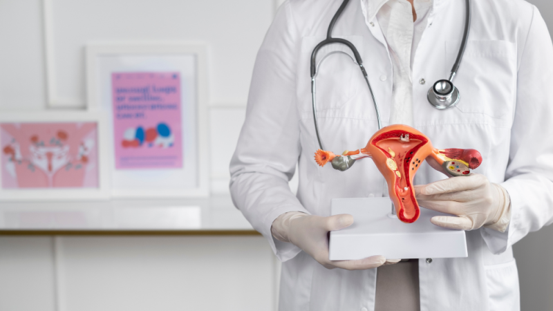 Memahami Penyakit Sindrom Ovarium Polikistik