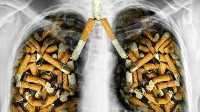 Penyakit Tentang Dampak Merokok Pada Tubuh