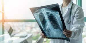 Cara Menjaga Kesehatan Paru-Paru agar Tetap Optimal
